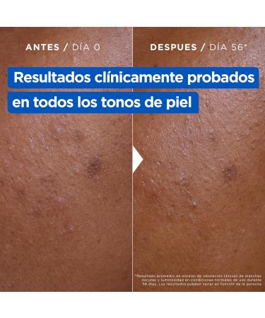 Mixa Niacinamide Bright antiblemish moisturizer 400 ml - Buy Online on GoSupps.com