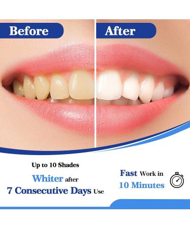 Lagunamoon Teeth Whitening Kit | 35% Urea Peroxide Gel with LED Light | No Sensitivity | Remove Coffee, Wine, Tea Stains - Buy Online on GoSupps.com