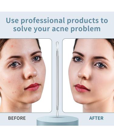 7 Pcs Blackhead Remover Tool Set for Face and Nose | Acne Extractor Kit with Leather Bag - Buy Online on GoSupps.com