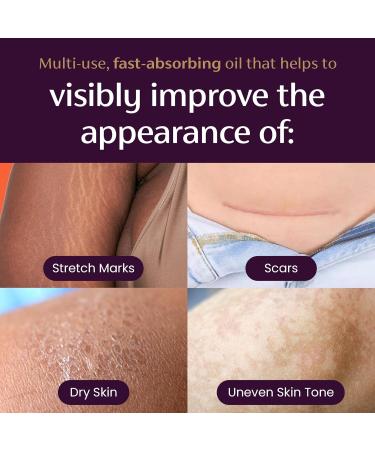 Mederma Quick Dry Oil - Scar and Stretch Mark Treatment Improves Appearance with Natural Botanical Extracts Paraben-Free Fast-Absorbing Hydrates Dry Skin Reduces Uneven Skin Tone 2.02 Oz (60ml) - Buy Online on GoSupps.com