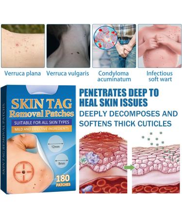 Anti Verrues Traitement Verrues Plantaires Patches Contre l Acn Wart Remover Patch Anti Acrochordons D tartrant Les Verrues Pour Les Mains et Les Pieds 180PC - Buy Online on GoSupps.com