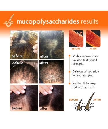 Hair & Scalp Revitalizing Shampoo with Biotin & Aloe Vera | Repairs Split Ends & Promotes Hair Growth | 8oz - Netwurks - Buy Online on GoSupps.com