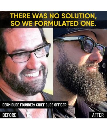 Derm Dude Advanced Beard Grooming Kit | Stimulate Facial Hair Growth | Complete Set with Wash Oil & Balm | Perfect Gifts for Men - Sandalwood & Cedar+Citrus - Buy Online on GoSupps.com