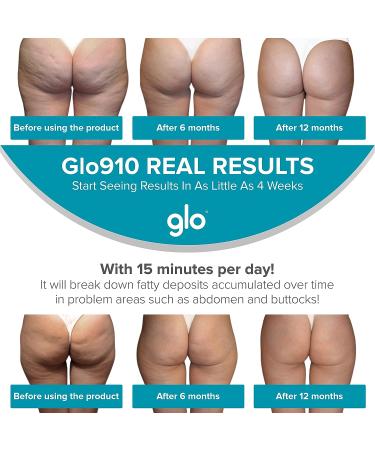 Glo910+ Anti Cellulite Massage Machine | 4 Massage Heads for Toning Legs, Butt, Thighs | Ideal for Body Scrub & Exfoliation - Buy Online on GoSupps.com