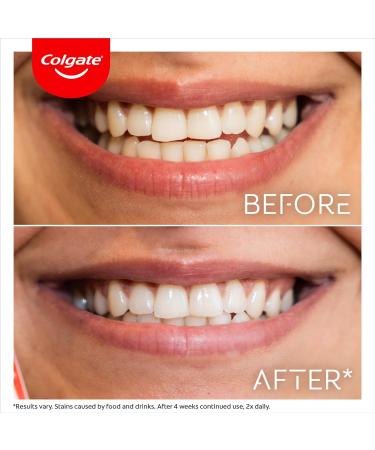 Colgate Max White Ultra Active Foam Teeth Whitening Toothpaste 75ml - Whitens Teeth in 3 Days, Enamel Safe Formula, Removes Deep Stains - Clinically Proven Fluoride Whitening Toothpaste - Buy Online on GoSupps.com