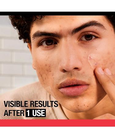 Stubborn Acne Pimple Patches - Invisible Hydrocolloid Face Patch for Redness Reduction | 10ct with Nose Cleaning Brush - Day & Night Solution - Buy Online on GoSupps.com