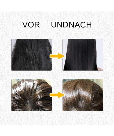  Holdes Moisturizing Shampoo | 150g Fortifying Care Shampoo with Massage Nozzle | Scalp Exfoliating Cream For all hair types women men and women on the go - Buy Online on GoSupps.com