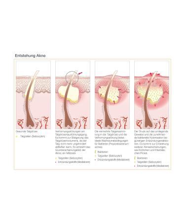 Aesthetico Vital Care - Clarifying Healing Treatment for Acne & Impure Skin | Refines Pores with Cucumber Extract | 50 ml (1 Pack) - International Shipping Available - Buy Online on GoSupps.com