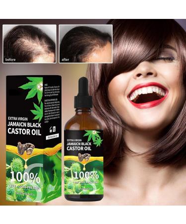Hair Growth Oil - Castor Oil for Hair Growth - Skin Care Pure Castor Oil Natural Hair Oil Aromatherapy Black Caster Oils Scalp Strengthening Oil for Eyelashes Eyebrows Hair & Skin - Buy Online on GoSupps.com