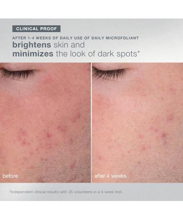 Dermalogica Warmth of the Winter Sun Travel Sized Skin Care Set Includes Face Exfoliants Facial Serum and Moisturizer with SPF - Buy Online on GoSupps.com