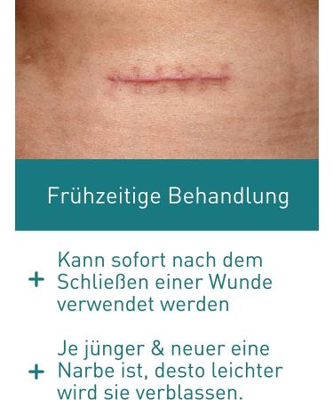 N1 Scar 19g - Effective Scar Care for Children & Adults | Relieve New & Old Scars | Flatter Softer & Less Visible Results - Pharmacy Approved - Buy Online on GoSupps.com