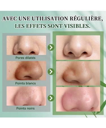 Peel-off Masque Facial au Charbon masque point noir visage masque anti point noir noirs et acn masque peel off visage convient aux hommes aux femmes et tous les types de peau. - Buy Online on GoSupps.com