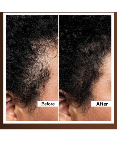  GNAUMORE 100% Natural Batana Oil Essential Oil for Hair Batana Batana Oil for Hair Batana Oil for Hair Growth Batana Oil for Hair Growth  - Buy Online on GoSupps.com