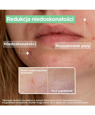 Mixa Anti-Blemish Face Serum Salicylic Acid & Niacinamide - Buy Online on GoSupps.com