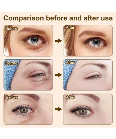 Snake Venom Eye Cream Chaffee Life Snake Venom Peptide Eye Serum Set for Firming and Anti-Wrinkle Treatment (4pcs) - Buy Online on GoSupps.com
