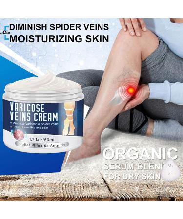 Varicose Veins Cream - Natural Treatment for Legs, Improve Blood Circulation, Strengthen Capillaries & Relieve Tired Legs - Buy Online on GoSupps.com