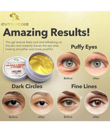CUTESKINS 60 pcs Hydrogel Under Eye Patches with Collagen, 24K Gold, Vitamin C & Retinol - For Puffiness, Dark Circles, Fine Lines, Wrinkles & Anti-Aging - Buy Online on GoSupps.com