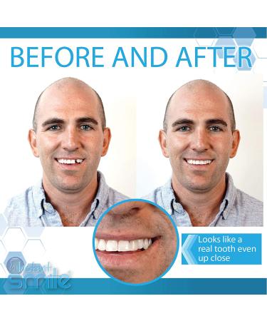 Instant Smile Tooth Replacement Kit - Complete Your Smile in Minutes - Patented Solution - Buy Online on GoSupps.com