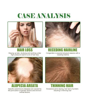 Rosemary Oil for Hair Growth - 59 ml Hair Care Oil (2 Pack) | Reduce Hair Loss & Nourish Scalp with Rosemary Mint Oil - Buy Online on GoSupps.com