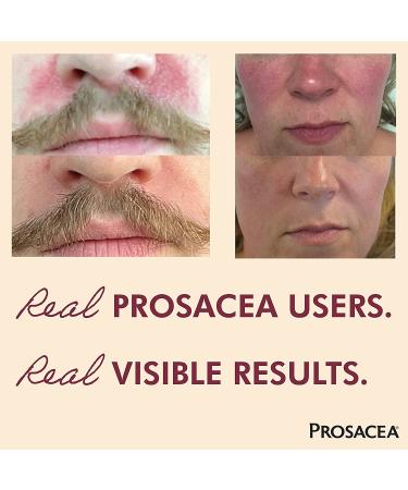 Prosacea Rosacea Treatment - 0.75 oz - Reduces Redness, Pimples, and Irritation - Buy Online on GoSupps.com