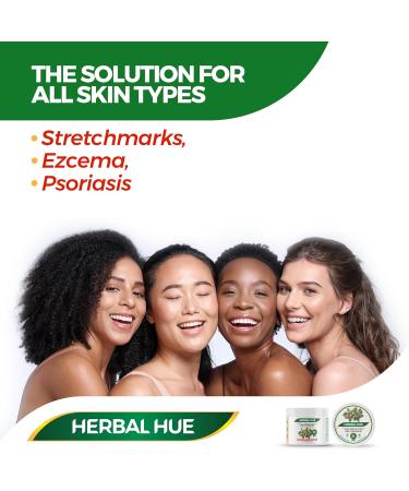 Herbal Hue 100% Natural Shea Butter 300ml Pure Raw Unrefined A Grade African Ivory All-Natural Smooth Shea Nut Body Butter Lip Balm Moisturiser Cream Lotion for All Skin Face Hair Type - Buy Online on GoSupps.com