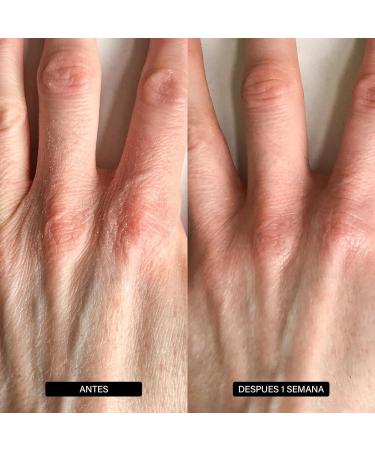  MUNTRADE Glycerin moisturizing hand cream - 3 x 200 ml - Moisturizes repairs absorbs quickly and leaves skin soft - Buy Online on GoSupps.com