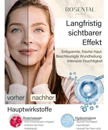 ROSENTAL Organics Hyaluronic Serum (30 ml) High Dose Organic Hyaluronic Acid Moisturiser for the Face Natural Cosmetics 100% Natural - Buy Online on GoSupps.com