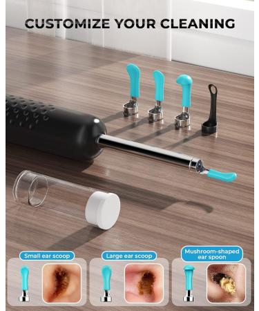 Wireless Otoscope with 1080P HD Camera - Ear Wax Removal Tool for iPhone & Android - Upgraded Ear Cleaner Kit - Buy Online on GoSupps.com