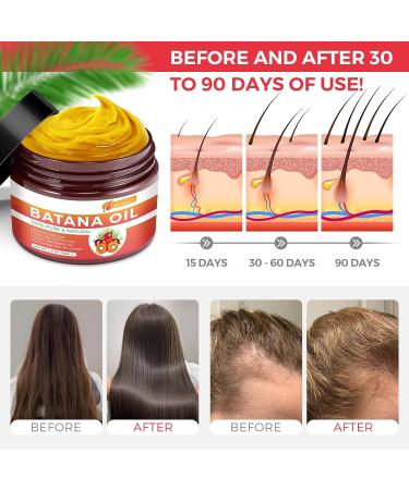 Unrefined Batana Oil for Hair Growth | 100% Pure Organic - Nourish Scalp Enhance Texture & Shine - 4.2 Oz - Buy Online on GoSupps.com