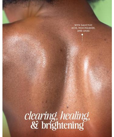 Truly Beauty Cherry Jelly Body Acne Wash - Soothing Niacinamide & Hydrating Allantoin Award-Winning Back Acne Treatment & Dark Spot Remover 8 Fl Oz - Buy Online on GoSupps.com