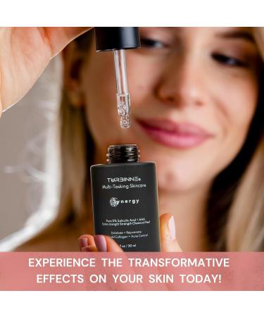 Turbinne Synergy Extra Strength Chemical Peel | 5% Salicylic Acid + AHA | Best Exfoliation & Acne Control | 30 mL / 1 fl. oz - Buy Now - Buy Online on GoSupps.com
