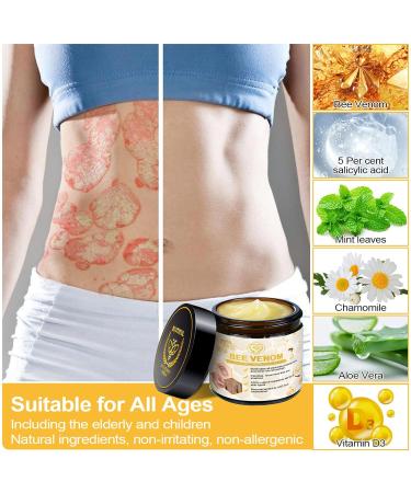 BIUTIFUL Bee Venom Skin Cream 2024 New Bee Venom Psoriasis Cream Beautiful Professional Bee Venom Correcting Cream for All Skin Types 1.69oz (3 Bottle) - Buy Online on GoSupps.com