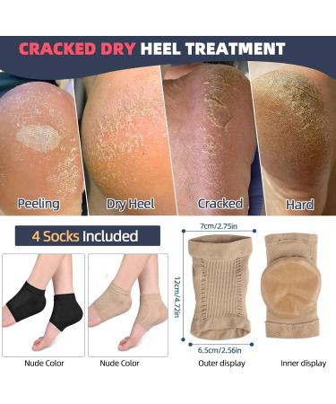 Cracked Heel Treatment Repair Socks - Premium Padded Compression Gel Sleeves for Dry Feet - 2 Pairs Spa Moisturizing Socks (One Size Fits Most - Buy Online on GoSupps.com