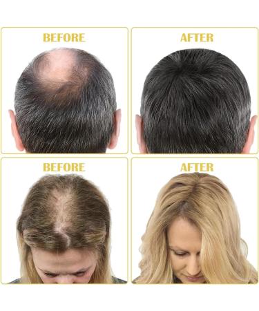 S rum anti-chute adapt aux hommes et aux femmes stimule la pousse de la barbe et des cheveux. Contient un masseur pour le cuir chevelu et une huile volumisante et paississante - Buy Online on GoSupps.com