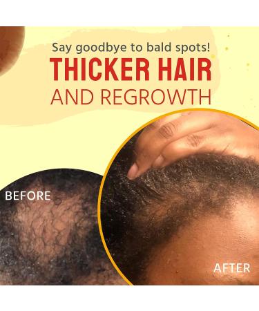 Glammed Naturally Hair Growth Oil - 100% Natural 2oz for Kids, Teen, Adult - Buy Online on GoSupps.com