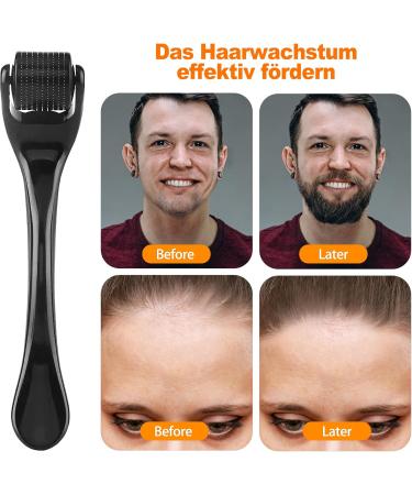 OioTuyi Beard Roller 0.5 mm Derma Roller Hair and Beard Care Derma Roller Hair Growth Microneedling Roller Micro Needle Roller for Men and Women Derma Roller Beard and Scalp - Buy Online on GoSupps.com