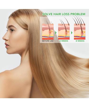  CUZZYDUNJYNN Rosemary routine shampoo for hair growth routine shampoo for women with hair loss and thinning hair with biotin nourishing smooth shampoo for men and - Buy Online on GoSupps.com