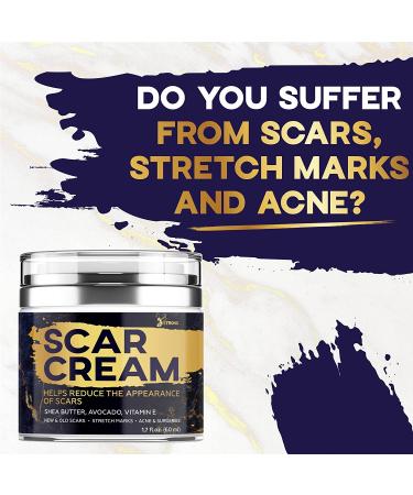 Natural Scar Removal Cream for Surgical, Acne, Cuts, Burns & Stretch Marks - Skin Renewal Support for Women & Men - All Skin Types - Buy Online on GoSupps.com