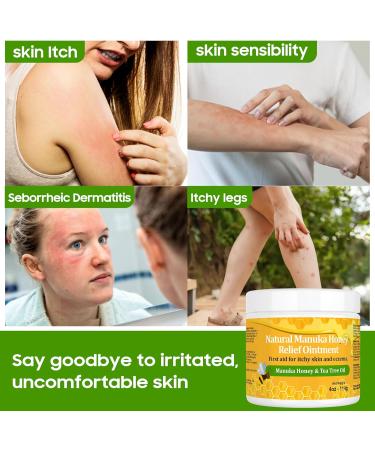 YOKOBBYES Draw Salve Manuka Honey Ointment Cream for Eczema Rosacea Psoriasis Folliculitis Seborrheic Dermatitis Anti-Itch for Soothing Relief Dry Itchy Irritated Skin 4 Ounce-1pack - Buy Online on GoSupps.com
