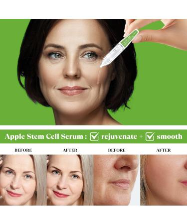 Buy Anti Aging Apple Stem Cell Serum Ampoule - Collagen Hyaluronic Acid & Niacinamide for Fine Lines & Wrinkles (30 Ampoules) | Rejuvenating & Hydrating Facial Serum - Buy Online on GoSupps.com