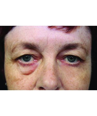 Rox Flawless Eyes by RX | Premium Eye Care for Radiant Skin | Shop Internationally Now - Buy Online on GoSupps.com