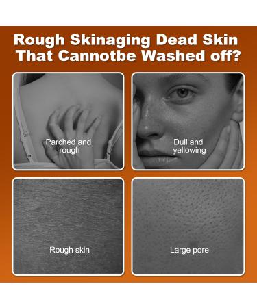 Peel Shot Keratin Care Kojic Acid Turmeric Spray 200ml - Exfoliating Body Spray with Retinol Niacinamide for Face & Body - Gentle Peeling Solution for Smooth All Skin Types (Yellow 1 Pack) - Buy Online on GoSupps.com