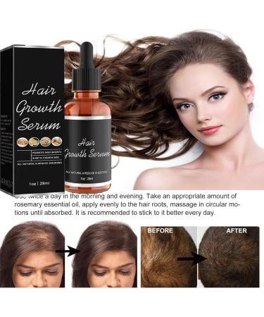 Hair Growth Serum Ginger Hair Oil for Hair Growth Hair Serum Strengthen Hair Roots for Thinning Balding Hair Hair Growth Oil Thickening Stronger Repairs Nourishes for Women Men Hair Care-29ML - Buy Online on GoSupps.com