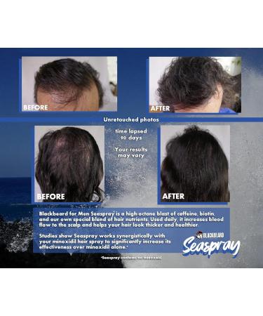 Blackbeard Seaspray Hair Energizer - Men's Biotin & Caffeine Hair Serum Spray for Thicker Fuller Hair - 2.1 Fl Oz Hair Thinning Treatment - Buy Online on GoSupps.com