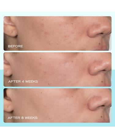 First Aid Beauty Dark Spot Serum with Niacinamide | Brighten Dark Spots & Hyperpigmentation - 1 oz | International Shipping - Buy Online on GoSupps.com