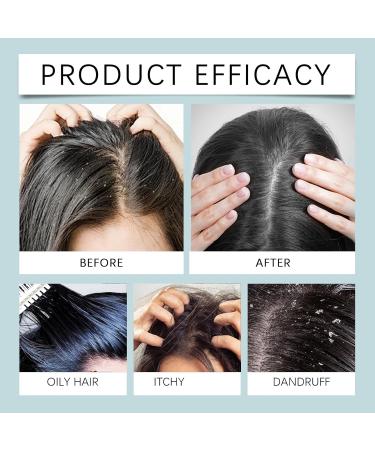 Gommage capillaire au romarin exfoliant pour un nettoyage et une nutrition en profondeur purifiant r gulateur de s bum apaisant et favorisant la pousse de cheveux sains. (1pcs) - Buy Online on GoSupps.com