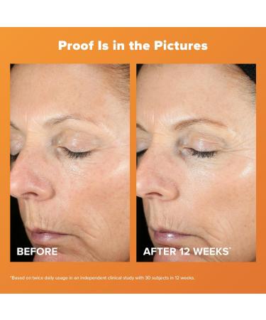 Paula's Choice C15 Super Booster 15% Vitamin C with Vitamin E & Ferulic Acid Brightening Serum for Discolouration Dark Spots & Wrinkles Fragrance-Free & Paraben- Free 20 mL - Buy Online on GoSupps.com