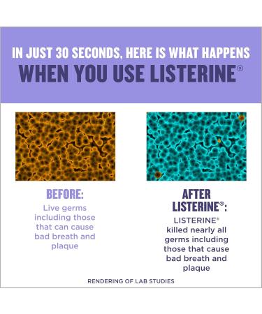 Listerine Alcohol Less Intense Mouthwash 1 l (Pack of 1) Mouthwash Green Tea - Buy Online on GoSupps.com