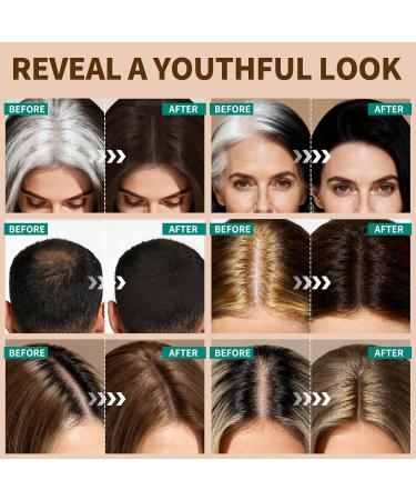 KIMUSE Hairline Powder Poudre de Retouche Racinaire qui Dissimule Instantan ment la Perte de Cheveux et les Zones Clairsem es avec Pinceau Double Pointe Black - Buy Online on GoSupps.com