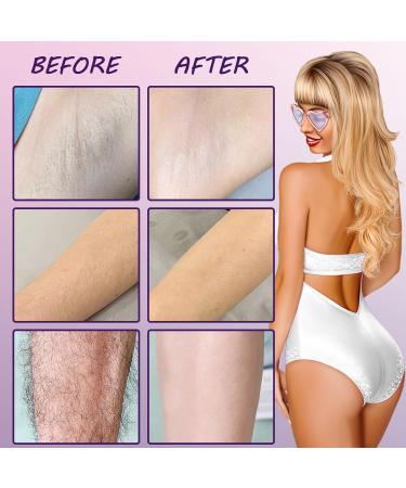 Hair Removal Cream for Women - Fast Painless Depilation for Smooth Skin | Underarm Bikini and Body Use - Buy Online on GoSupps.com